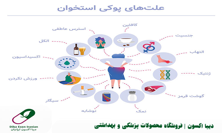 علت های ابتلا به پوکی استخوان