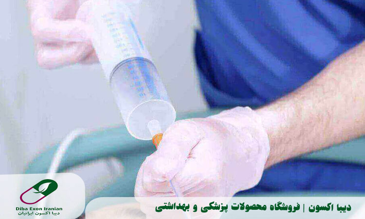 سوند معده چیست؟