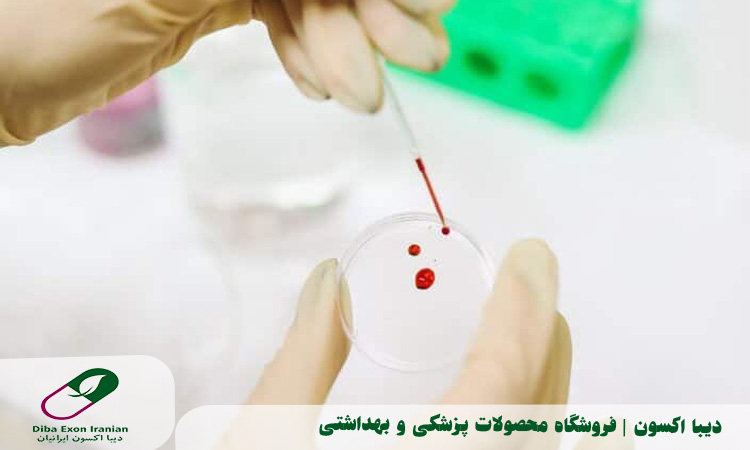 آشنایی با انواع آزمایش خون مهم